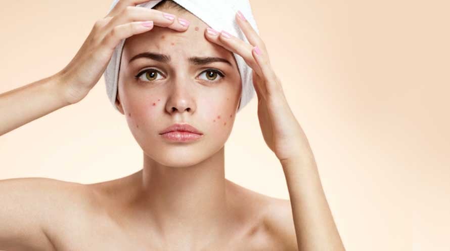 How to build a skincare routine to help with adult acne? Discover our step-by-step guide