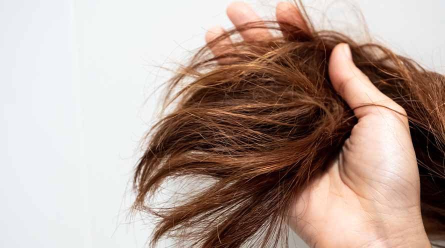 8 Major Causes Of Dry Hair That You Need To Know!