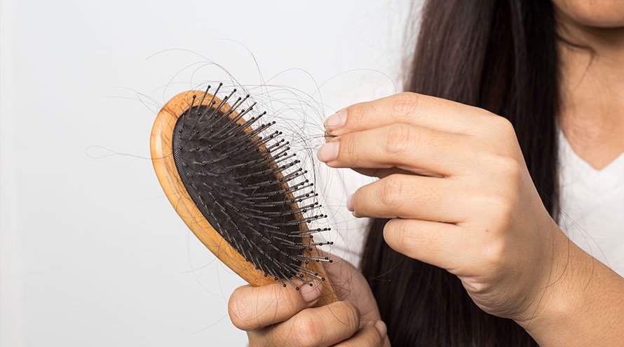Hair loss - Symptoms and causes - Mayo Clinic