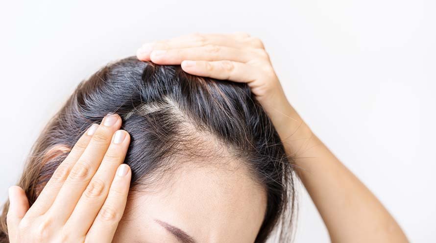 Different Types Of Scalp And How To Protect Them During Summers 