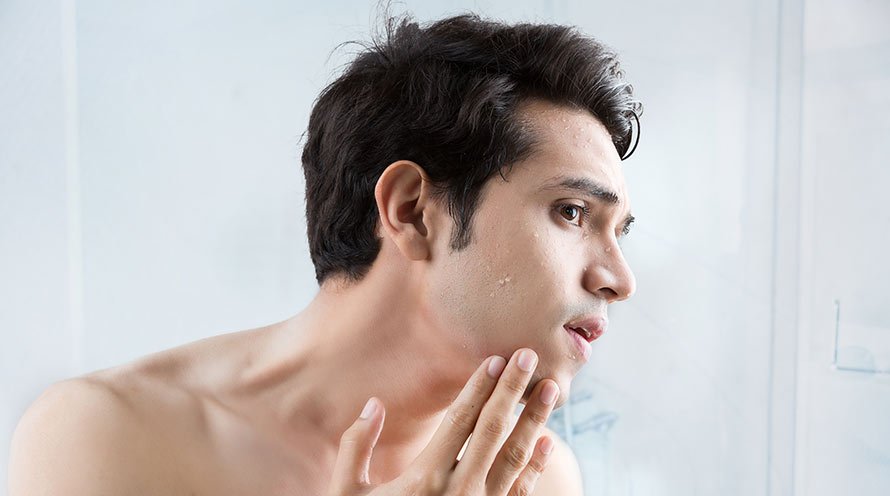 5 Causes of Dull Skin in Men – Reason For Dull Face