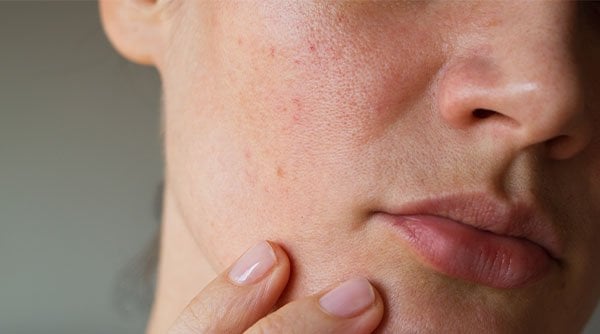 3 Ways to Choose the Best Moisturizer for Combination Skin