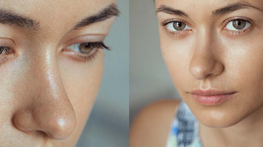 5 Signs That You Have Combination Skin Type