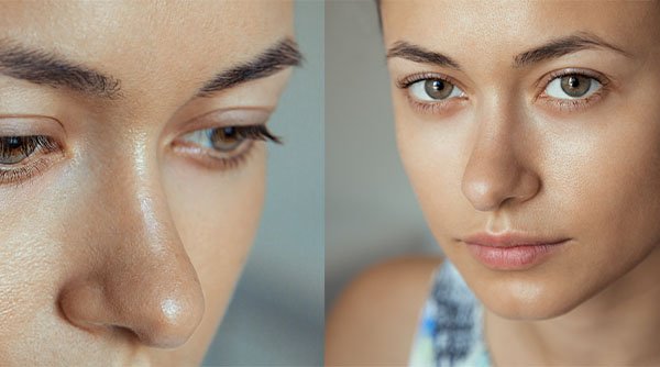 5 Signs That You Have Combination Skin Type
