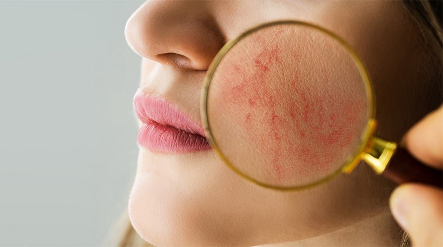 7 Foods That Help Fight Hyperpigmentation 