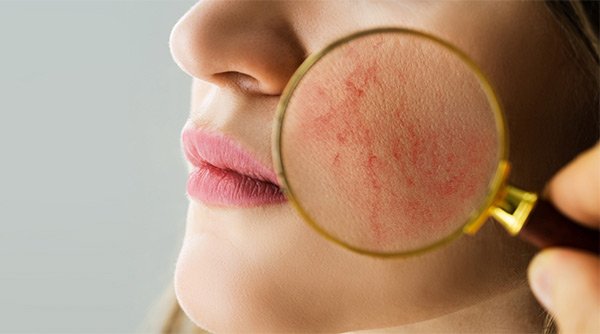 7 Foods That Help Fight Hyperpigmentation 