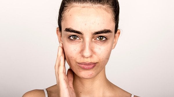 7-Step Oily Sensitive Skincare Routine