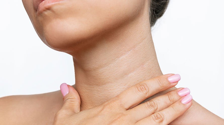 Neck Lines Solutions How To Remove Lines On Neck