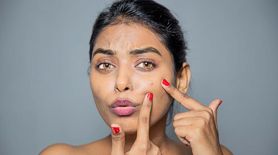 How to remove and dark spots from face – a step by step guide