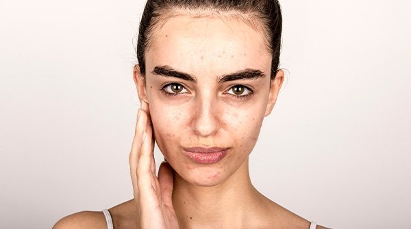 Pigmentation solution