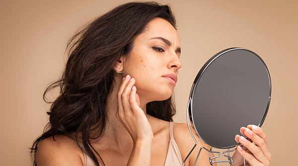 Pimples on Face thumbnail