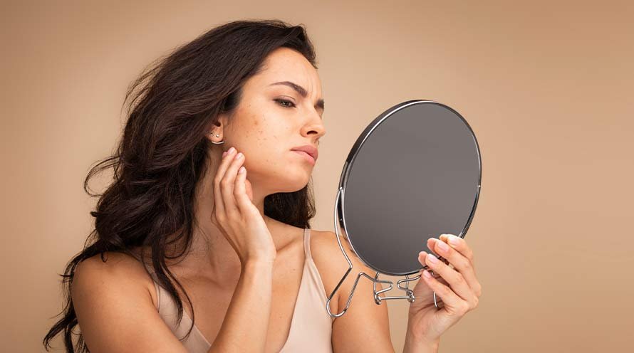 What Are the Causes of Pimples? 
