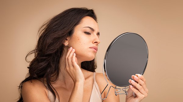 What Are the Causes of Pimples? 