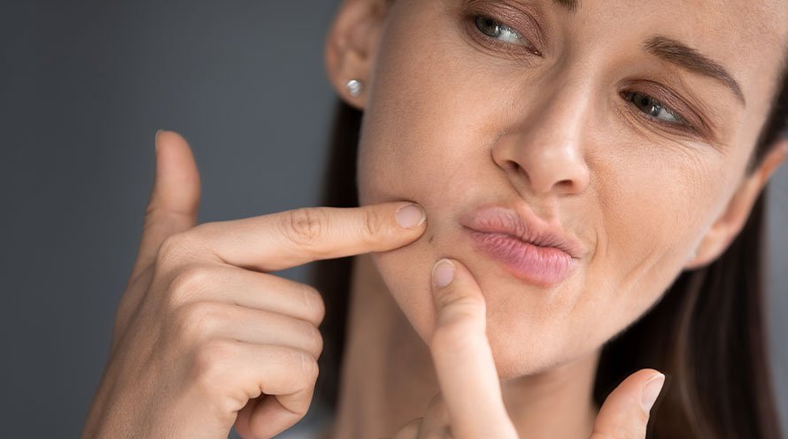 Why is it important to protect your skin barrier?