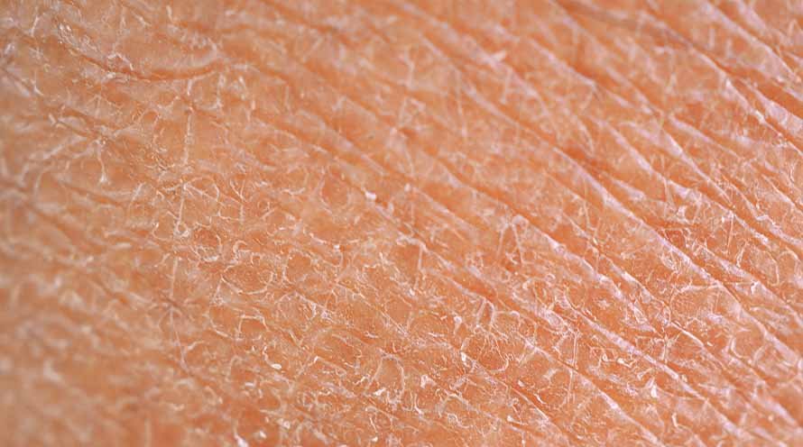 Winter Skin Care Tips - Winter 2022