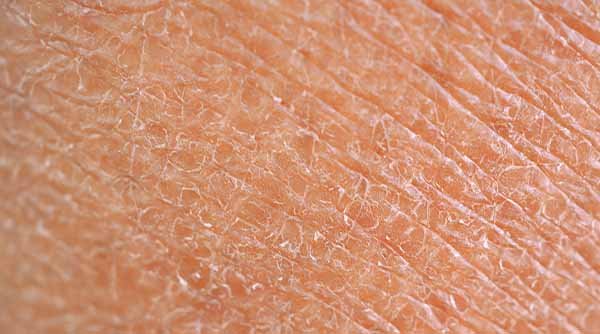 Winter Skin Care Tips - Winter 2022