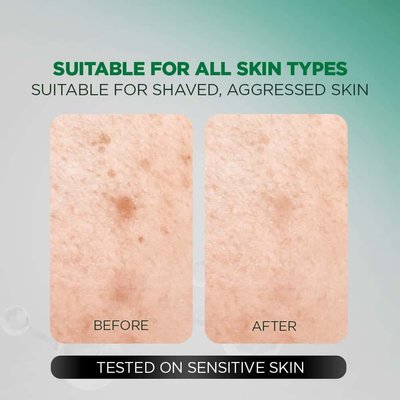 Acno Fight Acne Gel Cleanser is suitable for all skin types, shaved and aggressed skin
