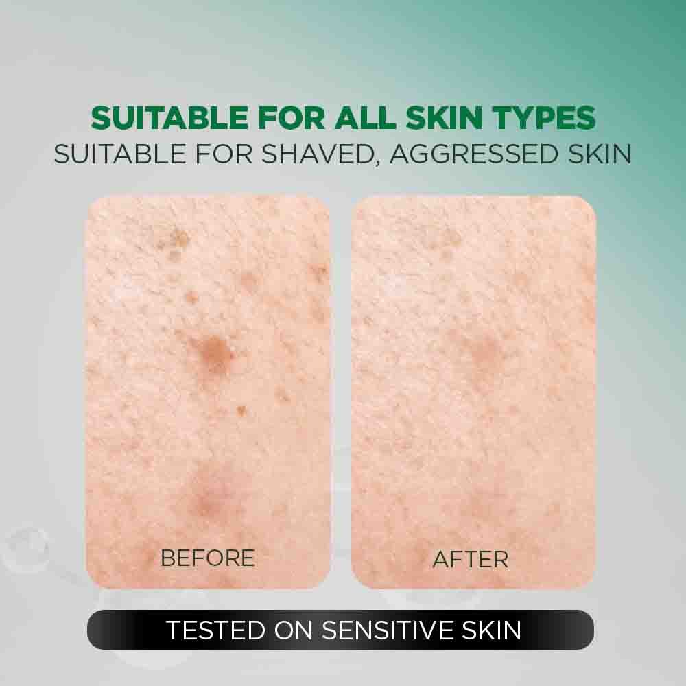 Garnier Men Acno Fight Gentle Gel Cleanser