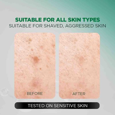 Garnier Men Acno Fight Gentle Gel Cleanser