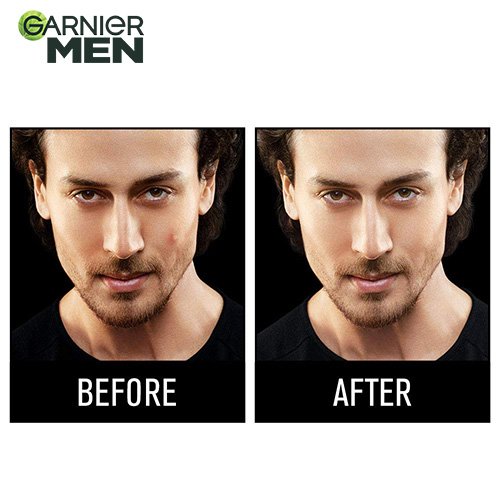 Garnier Men Acno Fight Pimple Clearing Brightenig Cream - Before After Image