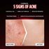 5 signs