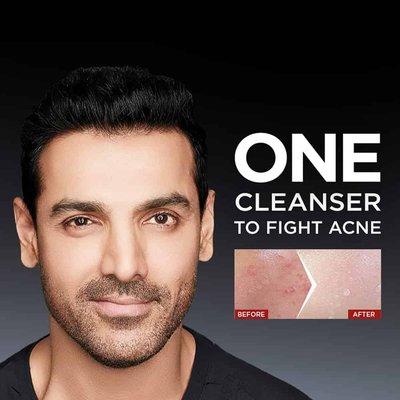 Before vs After Acne results with Garnier Men Acno Fight Anti Pimple Face Wash