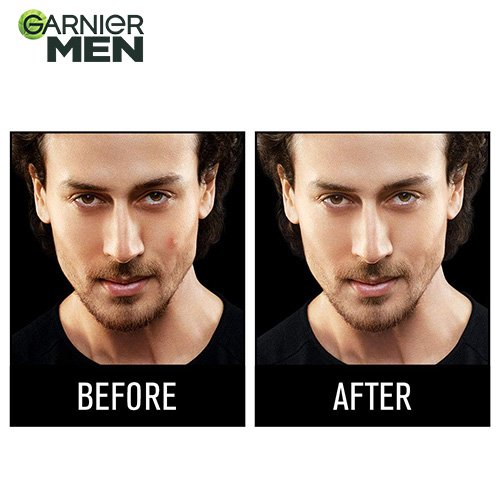 Garnier Men Acno Fight Anti Pimple Face Wash - Before After Image