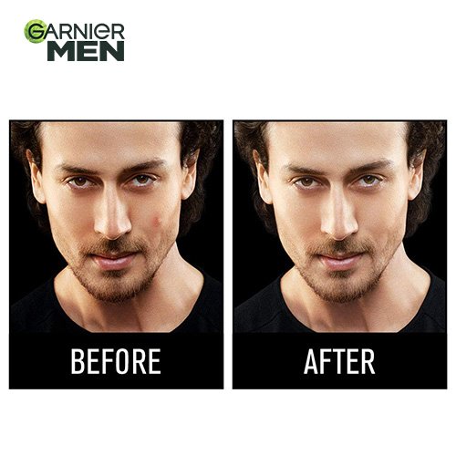 Garnier Men Acno Fight Anti Pimple Face Wash - Before After Image
