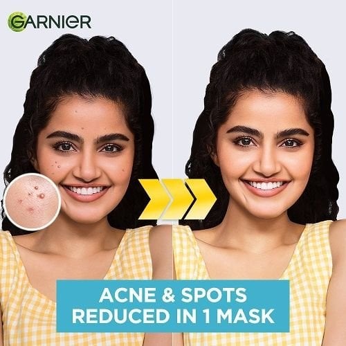 Bright Complete Anti Pimple Sheet Mask