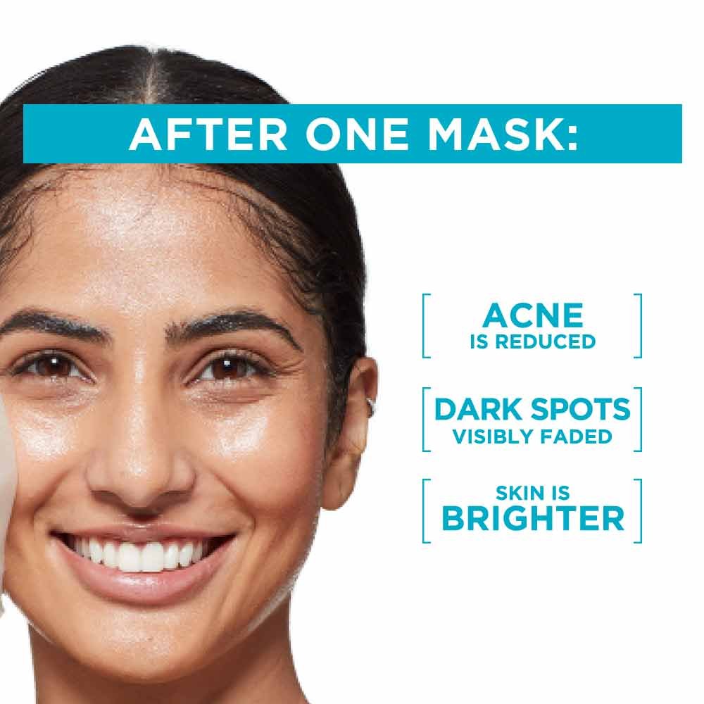 Garnier Anti Pimple Sheet Mask